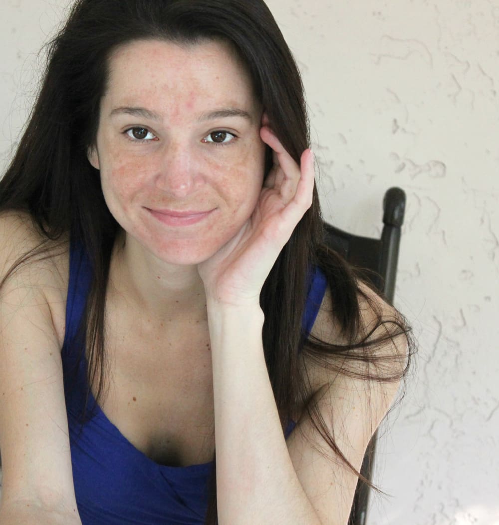 Galderma Rosacea, Rosacea, Skin Care, Stephanie Ziajka, Diary of a Debutante