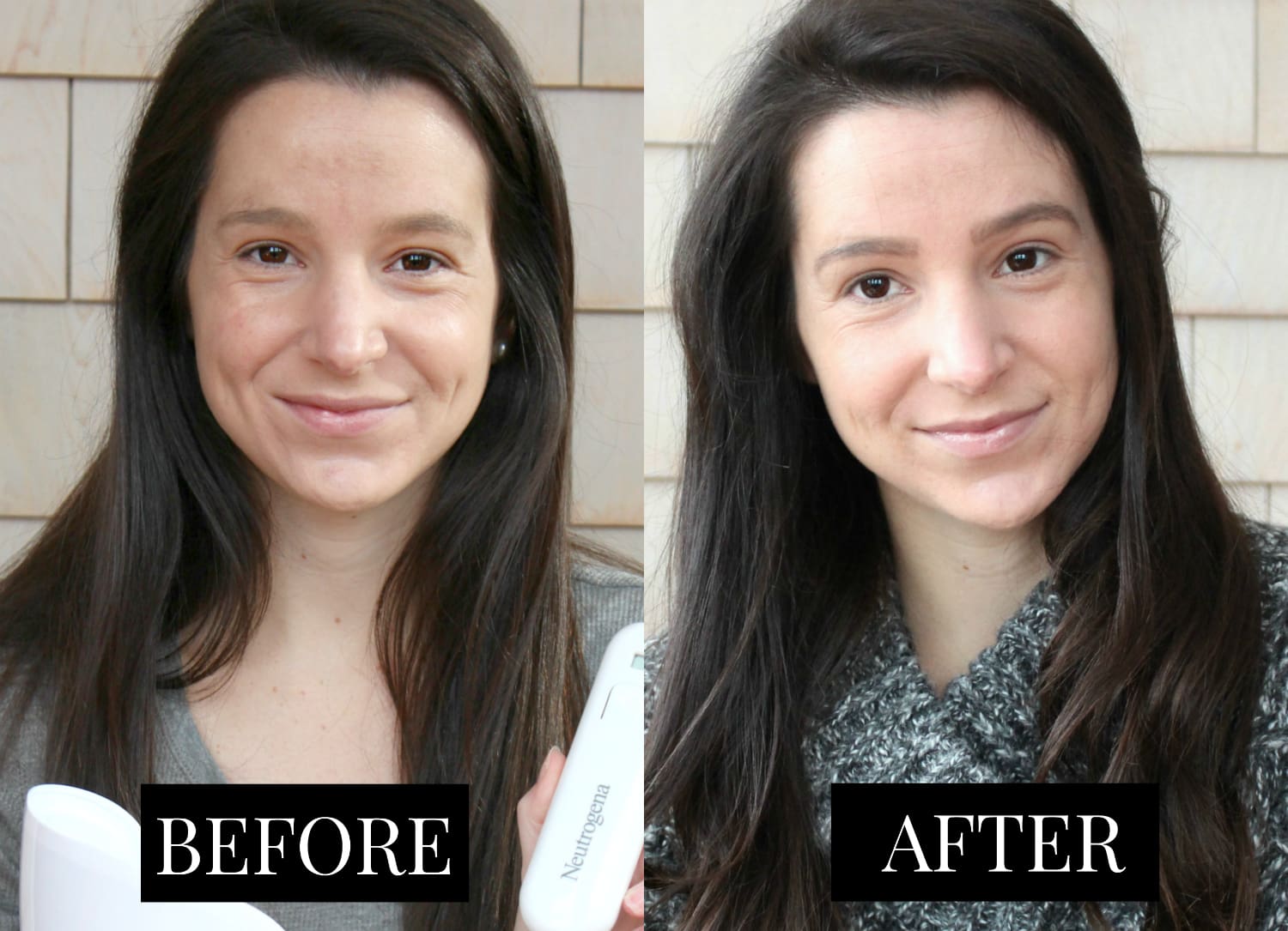 Benefits of light therapy for acne when using the new Neutrogena Light Therapy Acne Treatment Mask